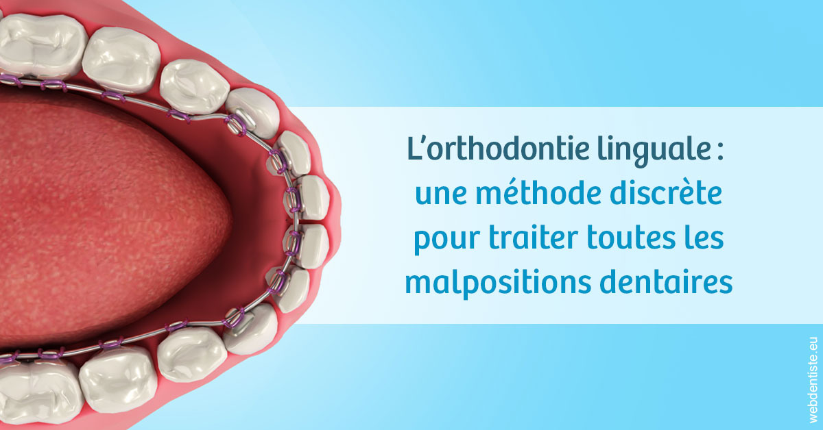 https://selarl-patrick-moheng-et-nicolas-moheng.chirurgiens-dentistes.fr/L'orthodontie linguale 1
