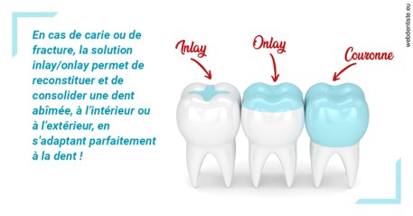 https://selarl-patrick-moheng-et-nicolas-moheng.chirurgiens-dentistes.fr/L'INLAY ou l'ONLAY