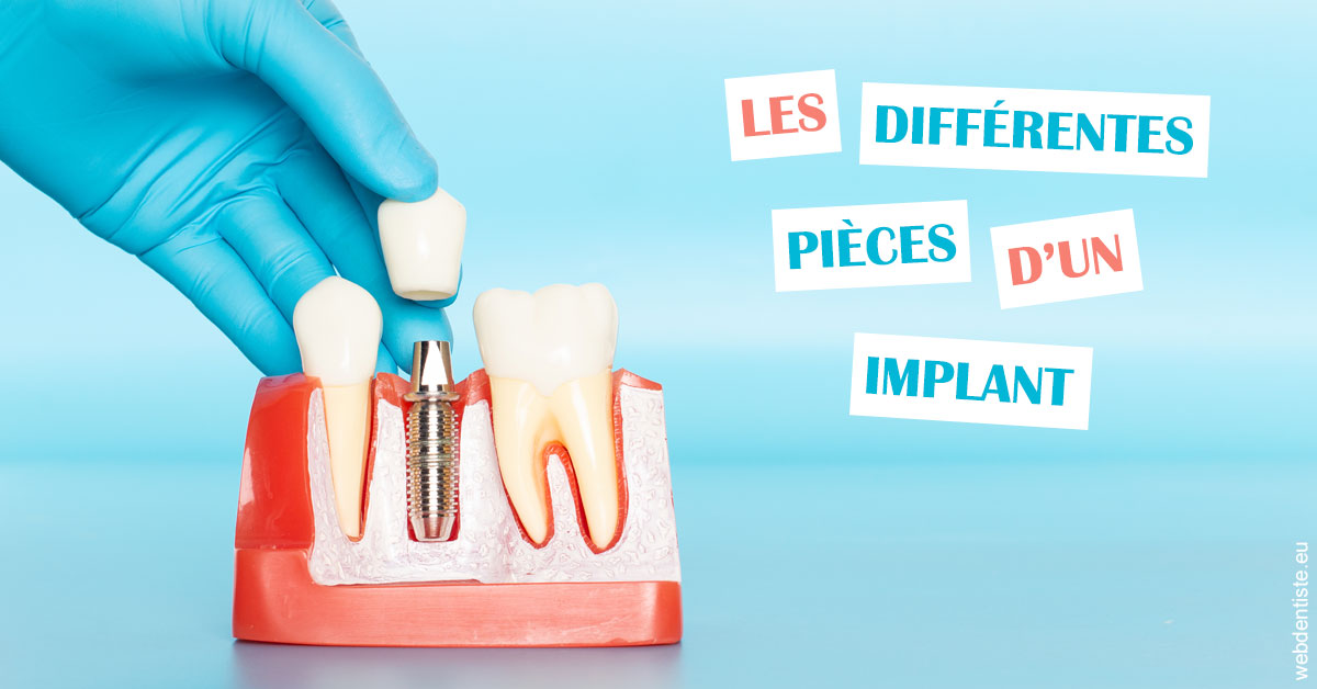 https://selarl-patrick-moheng-et-nicolas-moheng.chirurgiens-dentistes.fr/Les différentes pièces d’un implant 2