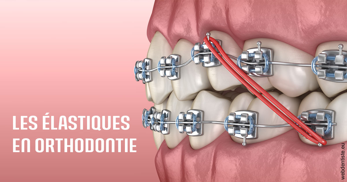 https://selarl-patrick-moheng-et-nicolas-moheng.chirurgiens-dentistes.fr/Elastiques orthodontie 2