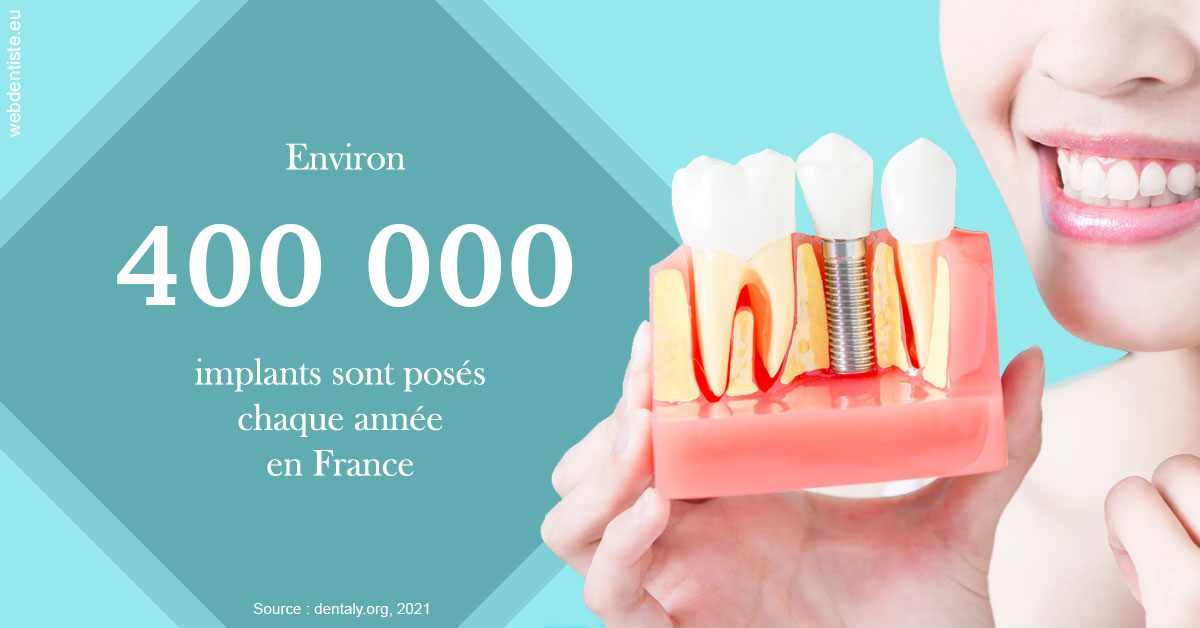 https://selarl-patrick-moheng-et-nicolas-moheng.chirurgiens-dentistes.fr/Pose d'implants en France 2